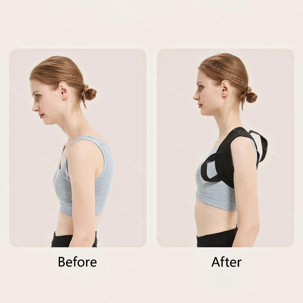Adjustable Back Posture Corrector – Unisex Spine & Shoulder Support Belt for Posture Correction and Body Shaping - Image 4